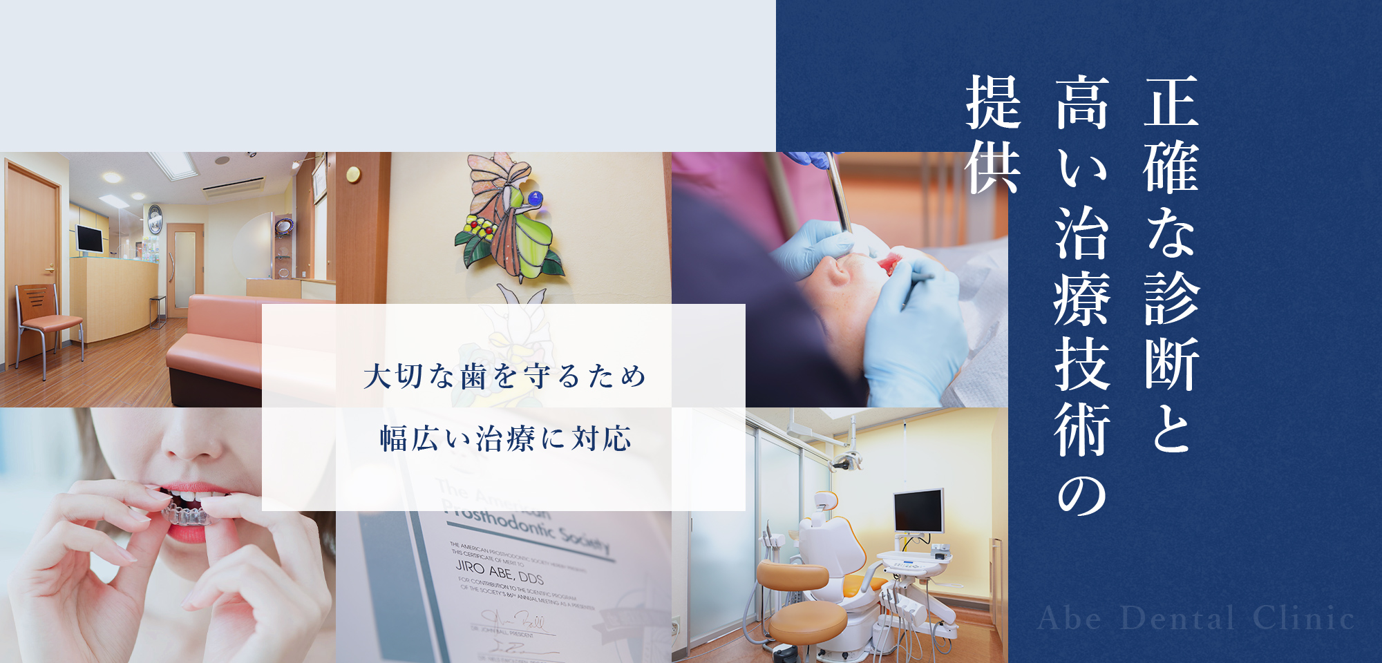 正確な診断と高い治療技術の提供 大切な歯を守るため 幅広い治療に対応