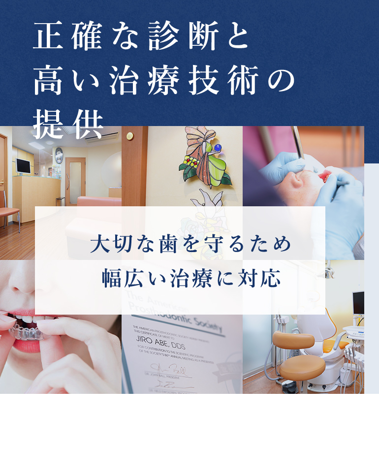 正確な診断と高い治療技術の提供 大切な歯を守るため 幅広い治療に対応