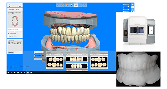 当院のデジタル義歯とは